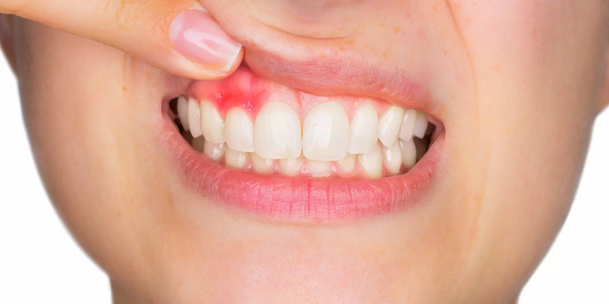 periodontoloji